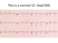 2 Great resources ECG Pedia -  ppt video online download
