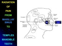 Sinusitis Part III Homeopathy 4 Everyone – January ppt download