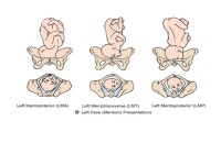 C H A P T E R1 7 Physiology and care during the transition and second stage phases of labour Dr. Areefa Albahri. -  ppt download