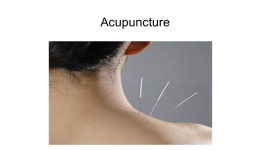 Disability Disability 1. Consequence of an impairment that may be:- Physical Cognitive Mental Sensory Emotional Developmental... 