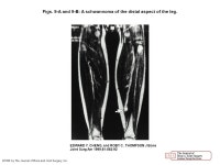 Instructional Course Lectures, The American Academy of Orthopaedic Surgeons - New Developments in the Staging and Imaging of Soft... 