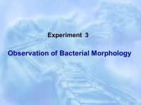 Experiment 2 Gram Stain and Acid-fast Stain.  Staining - simple stain (only one dye) - differential stain (more than one dye) G+G... 