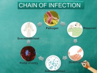 INFECTION CONTROL IN DENTAL LAB Revised by: C. Heston Created by: ANKIT PRABHAKAR GENESIS INSTITUTE OF DENTAL SCIENCES AND... 