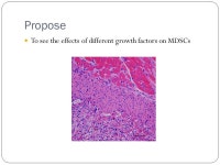 Experiment and Analysis by Henry Walther Pittsburgh Central Catholic High School Growth Factor Effects on MDSC Populations.... 