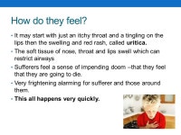 Food allergies and intolerances – module 1 Introduction to allergens and intolerances. -  ppt download