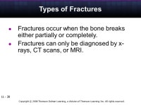 Copyright © 2008 Thomson Delmar Learning, a division of Thomson Learning Inc. All rights reserved The Skeletal System 5 5 U N I... 