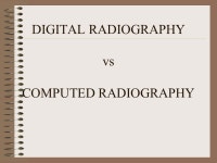 DIGITAL PROJECTION RADIOGRAPHY COMPUTED RADIOGRAPHY. -  ppt download