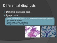 Clinical history  33 세, 남자  좌측 경부 콩알크기 종괴 (1 개월전 )  U/S: 좌측 level I, II, III, IV 에 커진 림프절 ( 최 대 3.1cm)  결핵성... 