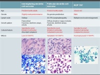 Clinical history  33 세, 남자  좌측 경부 콩알크기 종괴 (1 개월전 )  U/S: 좌측 level I, II, III, IV 에 커진 림프절 ( 최 대 3.1cm)  결핵성... 