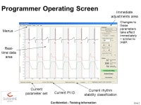Confidential – Training Information Slide 1 C-Pulse® Implantable Counterpulsation Pump Advanced Programmer Operation LBL E... 
