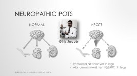 POSTURAL TACHYCARDIA SYNDROME (POTS) WHAT? WHY? HOW? Satish R Raj MD MSCI FACC FHRS FRCPC Associate Professor of Cardiac Sciences... 