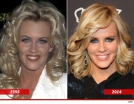 Jenny McCarthy: Good Genes or Good Docs?