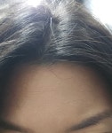 더쿠 - 이렇게 이마에 끼는 문제는 너무 많이 발라서 그런걸까?