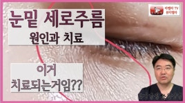 더쿠 - 눈 밑 세로주름 보톡스로 해결될까?