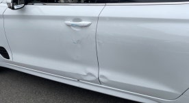 더쿠 - 이거 바디케어로 가능해?ㅠㅠㅠ