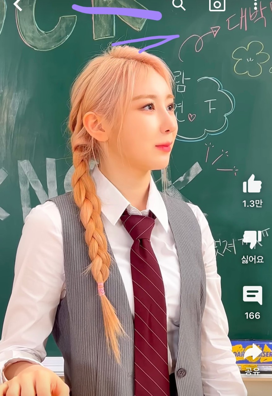 가수 이채연, 워터밤 후 탈모에 시달리며 모발 이식 고백 용기의 메시지