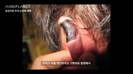 더쿠 - (사진주의) 주작소리 듣던 한의원 동상치료