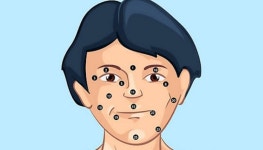 얼굴 점 위치에 각각 담긴 숨은 의미에 대한 모든 것 추가 설명서 (15번~25번)