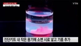 이슈/유머 - 집에서 간편하게 소변으로 방광암 진단 가능한 기술 개발