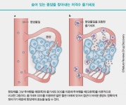 끝나지 않는 암과의 사투…암세포 저격수’로 나선 줄기세포 | 한국경제 [Cover Story - part.3] 끝나지 않는 암과의 사투…암세포... 
