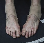 토슈즈 속 울퉁불퉁한 발, 이보다 아름다운 몸이 있을까 | 한국경제 토슈즈 속 울퉁불퉁한 발, 이보다 아름다운 몸이 있을까 