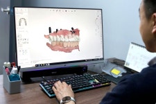 리얼스캔랩, 디지털 치과 전환 솔루션 서비스…쉽고 편하게 전환하세요 | 한국경제TV 리얼스캔랩, 디지털 치과 전환 솔루션 서비스…쉽고... 