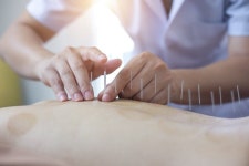 교통사고 나면 한방병원…안유진 발언에 한의사들 황당 | 한국경제 교통사고 나면 한방병원…안유진 발언에 한의사들 황당