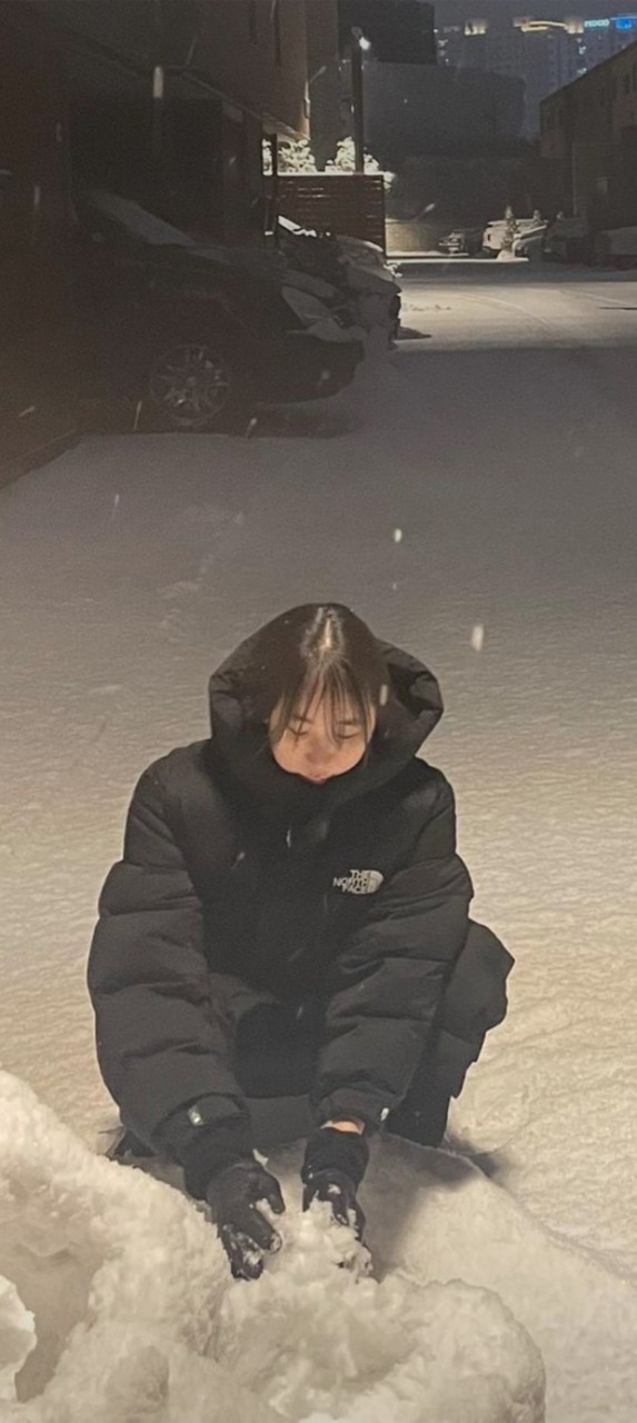 가수 이채연, 워터밤 후 탈모에 시달리며 모발 이식 고백 용기의 메시지