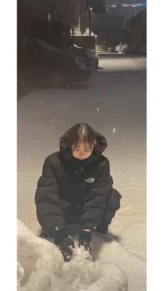 가수 이채연, 워터밤 후 탈모에 시달리며 모발 이식 고백 용기의 메시지