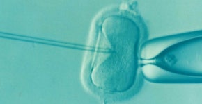 호주 여성, 죽은 남편 정자로 인공수정 하려 법원허가 신청 | 연합뉴스