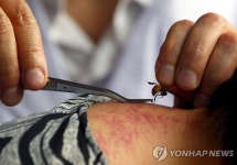 [김길원의 헬스노트] 봉침 사망에 되살아난 선한 사마리아인 딜레마 | 연합뉴스