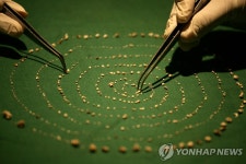 인도 7세 소년 턱에서 치아 526개 제거…복합치아종이 원인 | 연합뉴스