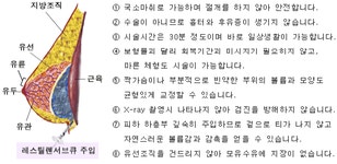 수술없이 안전한 트렌드, ‘쁘띠가슴성형’