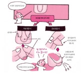 아기의 포경수술