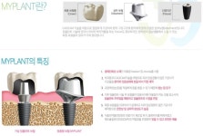 강남역야간진료치과 하는곳 전악임플란트 탁월한 사과나무치과 ♥