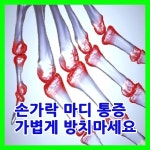 손가락 마디가 아픈이유 관절염주의하세요