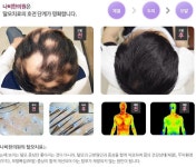 부산탈모치료병원은 근본적 원인을 치료하는 한의원에서