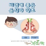 비염에 좋은 음식과 약초