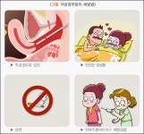자궁암 초기증상 꼭 알고 있어야 할 6가지✔