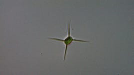 Lagerheimia genevensis from Ukima, Kita City, Tokyo 115-0051, Japan on 2023년 01월 05일 (목) at 11:08 오후 by someplant.... 