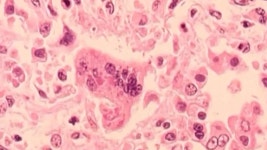 Noovo Info 17 | 13-01-2025 | L’actualité par Noovo Info – Noovo Info 17 (Season 5, Episode 96) - Apple TV (CA)