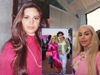 성형 Archives - 128 중 13 번째 페이지 - 코메디닷컴