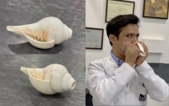 중외제약, 관절염 치료제 3상시험 완료 - 코메디닷컴