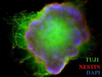Cytokines for Organoid Culture | 연구용제품 > Bio마켓 | BRIC
