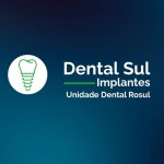 Dental Rosul Implantes(@dentalrosul) • Instagram 사진 및 동영상