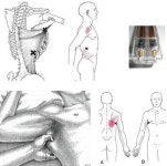 제4경추 ~ 흉추 1번 - ├……제니센 처방전 - 힐링 라이프 힐링 라이프