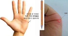 Re: 골프엘보의 원인과 제니센 터치 치료방법 해설 - ▣ 제니센 치료 상담사례 - 건강한 삶을 열어가는 힐링라이프 건강한 삶을 열어가는 힐링라이프