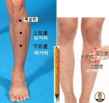 장 폐색증의 원인과 장 폐색증 제니센 터치 치유 방법 - ▣ 제니센 터치 치유상담 - 힐링 라이프 장 폐색증의 원인과 장 폐색증 제니센 터치 치유 방법