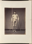 Guerre Des Etats-Unis. 1861 a 1866. Chirurgie Conservatrice. Photographies. (Getty Museum)