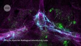 Guardians of the brain: how a special immune system protects our grey matter